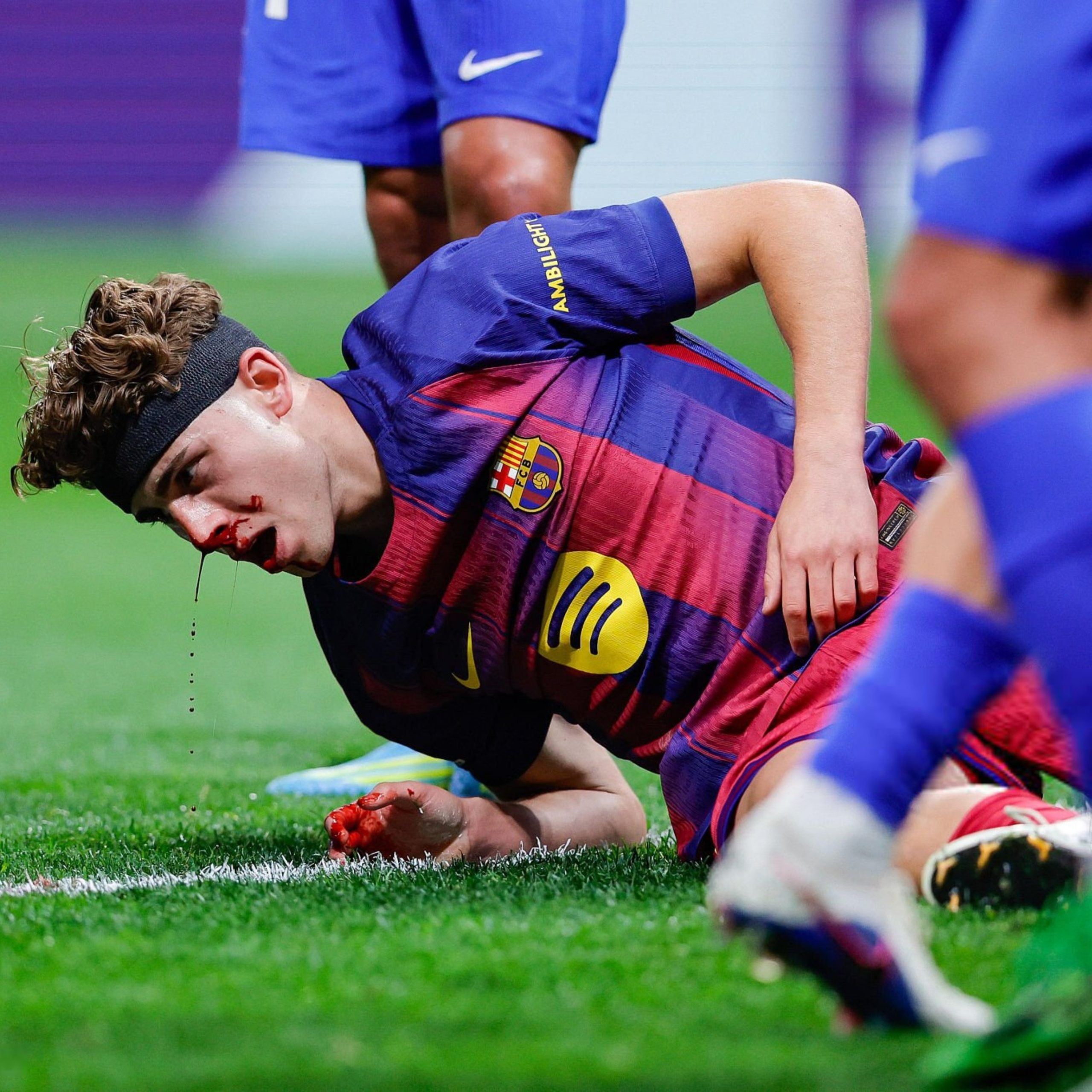 فيرمين يخضع لعلاج مكثف بعد إصابة قوية في مواجهة أتلتيكو مدريد – كورة 999